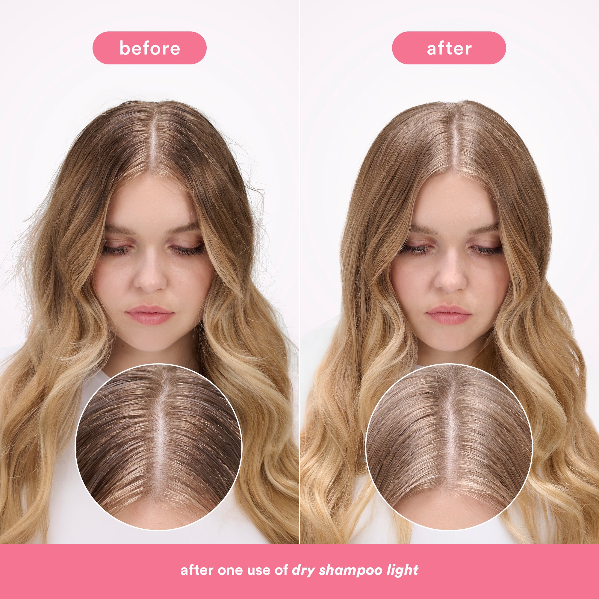 Dry Shampoo
